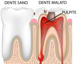 pulpite