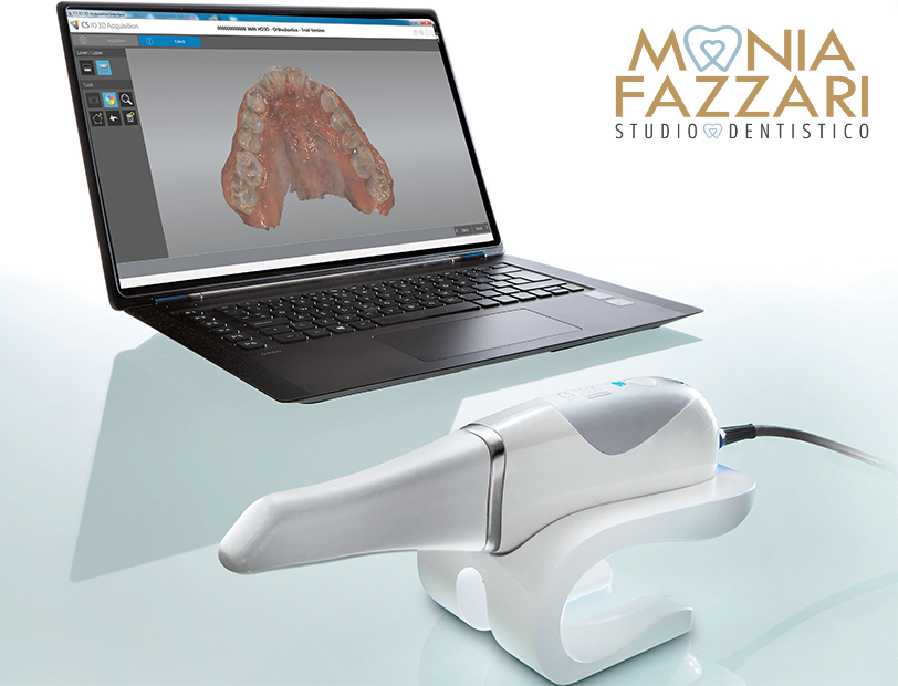 scanner intraorale-impronte dentali